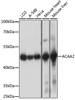 ACAA2 Polyclonal Antibody&nbsp;<img src="images/icon_newarrival.gif" alt="new" border="0">