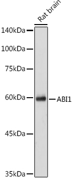 ABI1 Polyclonal Antibody&nbsp;<img src="images/icon_newarrival.gif" alt="new" border="0">
