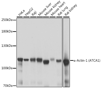 a-Actinin-4 Polyclonal Antibody&nbsp;<img src="images/icon_newarrival.gif" alt="new" border="0">