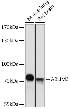 ABLIM3 Polyclonal Antibody&nbsp;<img src="images/icon_newarrival.gif" alt="new" border="0">