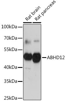 ABHD12 Polyclonal Antibody&nbsp;<img src="images/icon_newarrival.gif" alt="new" border="0">