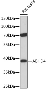 ABHD4 Polyclonal Antibody&nbsp;<img src="images/icon_newarrival.gif" alt="new" border="0">