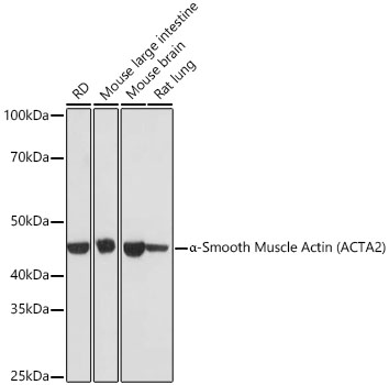 a-Smooth Muscle Actin (ACTA2) Monoclonal Antibody&nbsp;<img src="images/icon_newarrival.gif" alt="new" border="0">