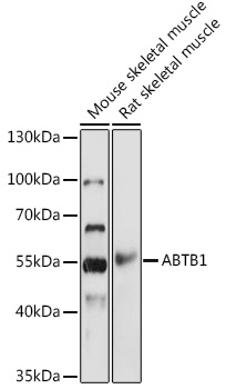 ABTB1 Polyclonal Antibody&nbsp;<img src="images/icon_newarrival.gif" alt="new" border="0">