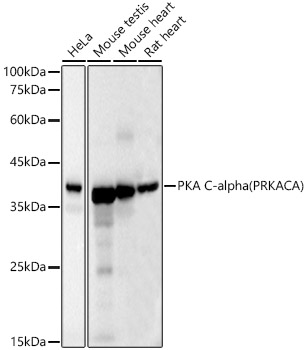 PKA C-alpha (PRKACA) Monoclonal Antibody&nbsp;<img src="images/icon_newarrival.gif" alt="new" border="0">