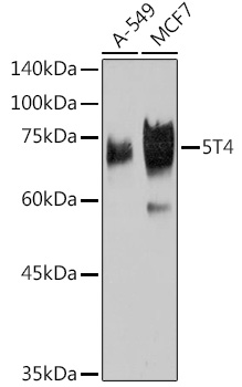 5T4 Monoclonal Antibody&nbsp;<img src="images/icon_newarrival.gif" alt="new" border="0">