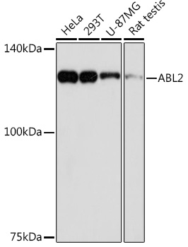 ABL2 Monoclonal Antibody&nbsp;<img src="images/icon_newarrival.gif" alt="new" border="0">