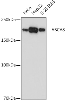 ABCA8 Polyclonal Antibody&nbsp;<img src="images/icon_newarrival.gif" alt="new" border="0">