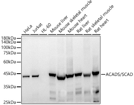 ACADS / SCAD Monoclonal Antibody&nbsp;<img src="images/icon_newarrival.gif" alt="new" border="0">