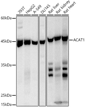 ACAT1 Monoclonal Antibody&nbsp;<img src="images/icon_newarrival.gif" alt="new" border="0">