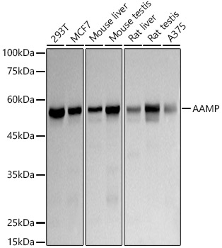 AAMP Monoclonal Antibody&nbsp;<img src="images/icon_newarrival.gif" alt="new" border="0">