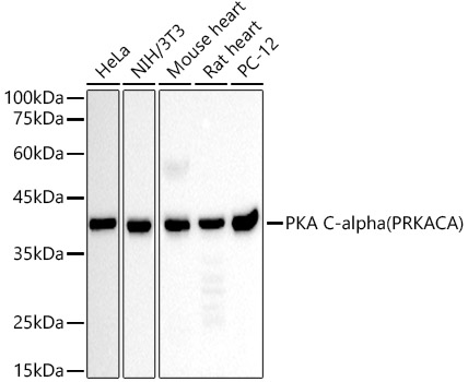 PKA C-alpha (PRKACA) Monoclonal Antibody&nbsp;<img src="images/icon_newarrival.gif" alt="new" border="0">