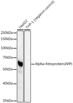 Alpha-Fetoprotein (AFP) Monoclonal Antibody&nbsp;<img src="images/icon_newarrival.gif" alt="new" border="0">
