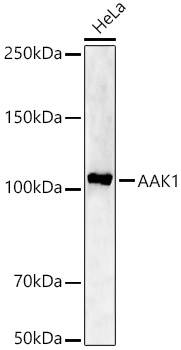 AAK1 Polyclonal Antibody&nbsp;<img src="images/icon_newarrival.gif" alt="new" border="0">