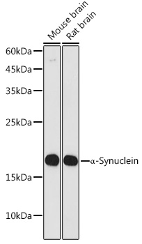 a-Synuclein Monoclonal Antibody&nbsp;<img src="images/icon_newarrival.gif" alt="new" border="0">
