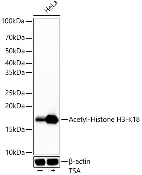 Acetyl-Histone H3-K18 Monoclonal Antibody&nbsp;<img src="images/icon_newarrival.gif" alt="new" border="0">