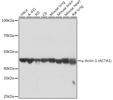a-Actin-1 (ACTA1) Monoclonal Antibody&nbsp;<img src="images/icon_newarrival.gif" alt="new" border="0">