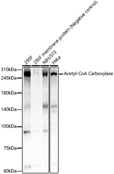 Acetyl-CoA Carboxylase Monoclonal Antibody&nbsp;<img src="images/icon_newarrival.gif" alt="new" border="0">