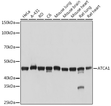 a-Actin-1 (ACTA1) Monoclonal Antibody&nbsp;<img src="images/icon_newarrival.gif" alt="new" border="0">