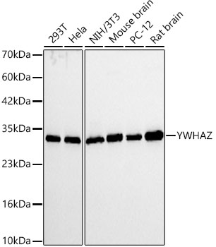 14-3-3 zeta/YWHAZ Monoclonal Antibody&nbsp;<img src="images/icon_newarrival.gif" alt="new" border="0">