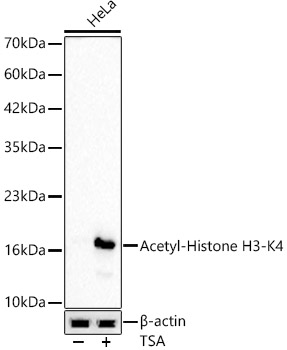 Acetyl-Histone H3-K4 Monoclonal Antibody&nbsp;<img src="images/icon_newarrival.gif" alt="new" border="0">