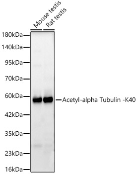 Acetyl-alpha Tubulin -K40 Monoclonal Antibody&nbsp;<img src="images/icon_newarrival.gif" alt="new" border="0">