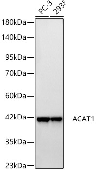 ACAT1 Monoclonal Antibody&nbsp;<img src="images/icon_newarrival.gif" alt="new" border="0">