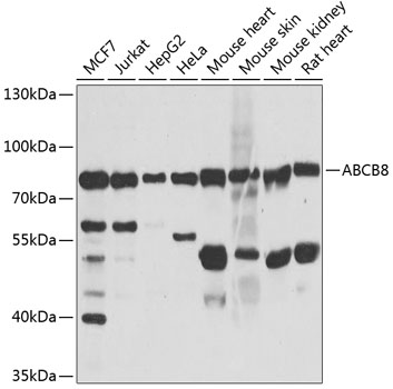 ABCB8 Polyclonal Antibody&nbsp;<img src="images/icon_newarrival.gif" alt="new" border="0">