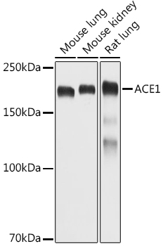 ACE1 Polyclonal Antibody&nbsp;<img src="images/icon_newarrival.gif" alt="new" border="0">