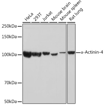 a-Actinin-4 Monoclonal Antibody&nbsp;<img src="images/icon_newarrival.gif" alt="new" border="0">