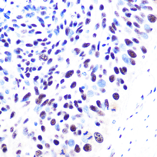 53BP1 Monoclonal Antibody&nbsp;<img src="images/icon_newarrival.gif" alt="new" border="0">