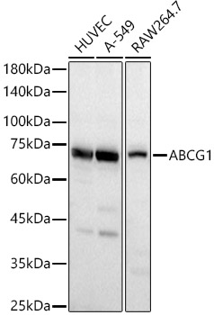 ABCG1 Polyclonal Antibody&nbsp;<img src="images/icon_newarrival.gif" alt="new" border="0">