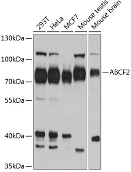 ABCF2 Polyclonal Antibody&nbsp;<img src="images/icon_newarrival.gif" alt="new" border="0">