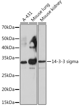 14-3-3 sigma Monoclonal Antibody&nbsp;<img src="images/icon_newarrival.gif" alt="new" border="0">
