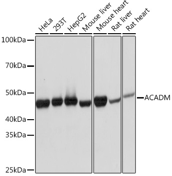 ACADM Monoclonal Antibody&nbsp;<img src="images/icon_newarrival.gif" alt="new" border="0">