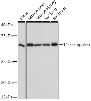 14-3-3 epsilon Monoclonal Antibody&nbsp;<img src="images/icon_newarrival.gif" alt="new" border="0">