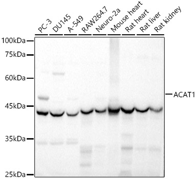 ACAT1 Polyclonal Antibody&nbsp;<img src="images/icon_newarrival.gif" alt="new" border="0">