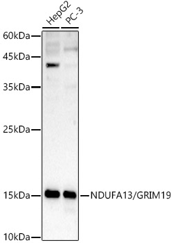 NDUFA13/GRIM19 Polyclonal Antibody&nbsp;<img src="images/icon_newarrival.gif" alt="new" border="0">