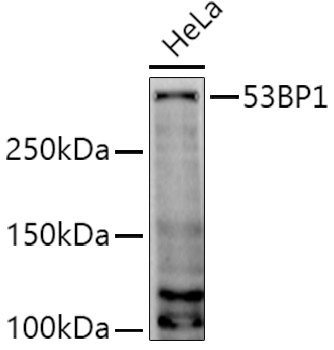 53BP1 Polyclonal Antibody&nbsp;<img src="images/icon_newarrival.gif" alt="new" border="0">