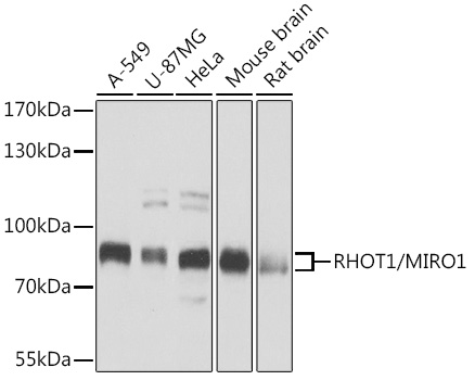RHOT1/MIRO1 Polyclonal Antibody&nbsp;<img src="images/icon_newarrival.gif" alt="new" border="0">