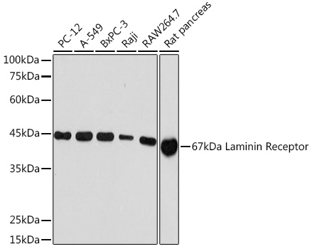 67kDa Laminin Receptor Monoclonal Antibody&nbsp;<img src="images/icon_newarrival.gif" alt="new" border="0">