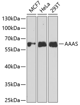 AAAS Polyclonal Antibody&nbsp;<img src="images/icon_newarrival.gif" alt="new" border="0">