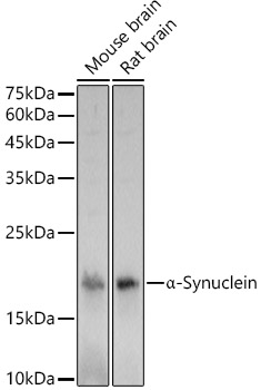 a-Synuclein Polyclonal Antibody&nbsp;<img src="images/icon_newarrival.gif" alt="new" border="0">