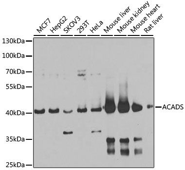 ACADS Polyclonal Antibody&nbsp;<img src="images/icon_newarrival.gif" alt="new" border="0">