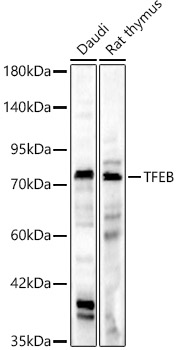 TFEB Polyclonal Antibody&nbsp;<img src="images/icon_newarrival.gif" alt="new" border="0">