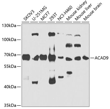 ACAD9 Polyclonal Antibody&nbsp;<img src="images/icon_newarrival.gif" alt="new" border="0">