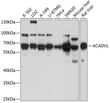 ACADVL Polyclonal Antibody&nbsp;<img src="images/icon_newarrival.gif" alt="new" border="0">