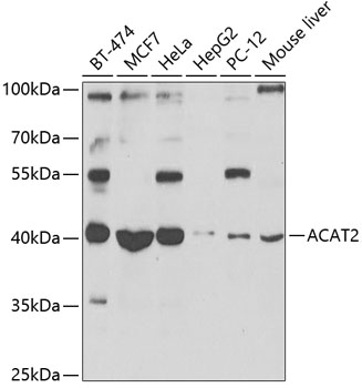 ACAT2 Polyclonal Antibody&nbsp;<img src="images/icon_newarrival.gif" alt="new" border="0">