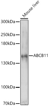 ABCB11 Polyclonal Antibody&nbsp;<img src="images/icon_newarrival.gif" alt="new" border="0">