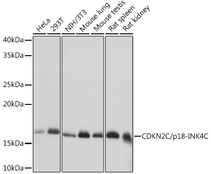 CDKN2C/p18-INK4C Monoclonal Antibody&nbsp;<img src="images/icon_newarrival.gif" alt="new" border="0">